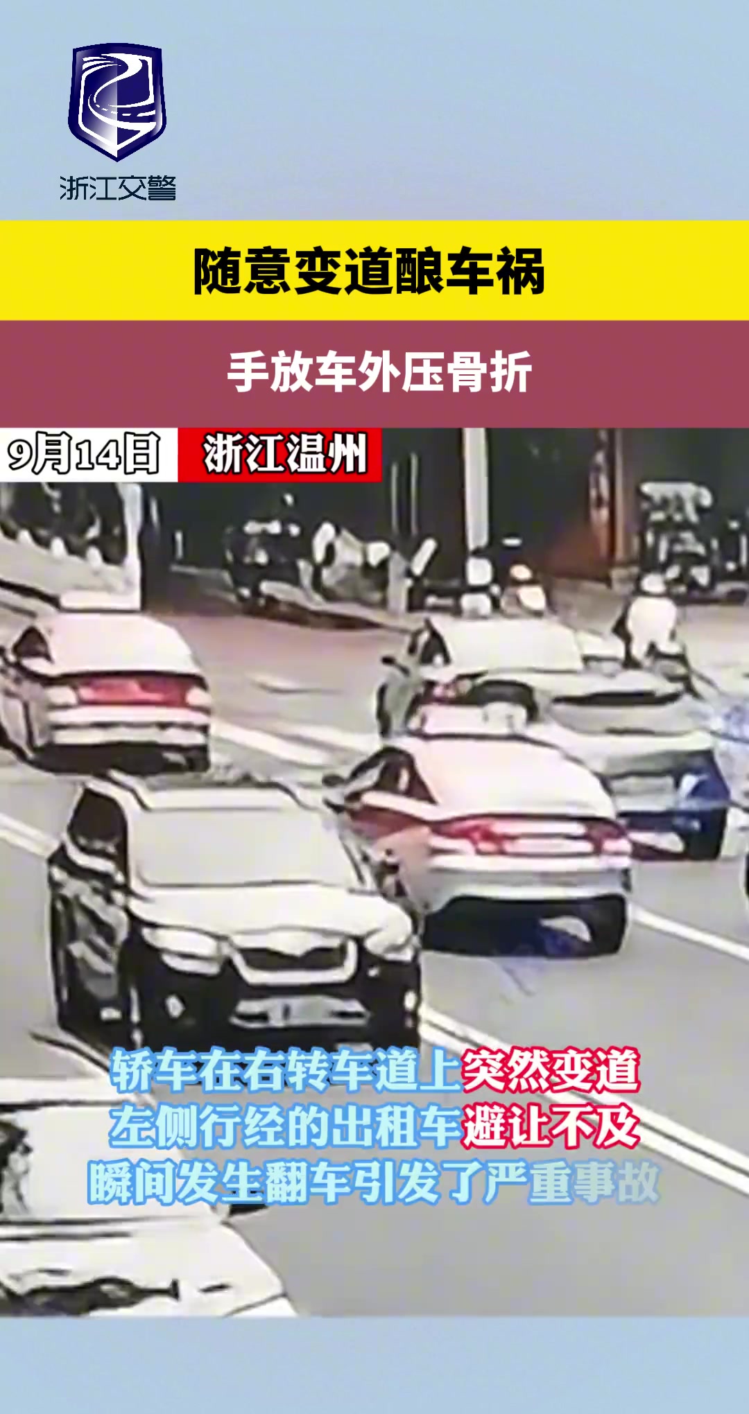 随意变道酿车祸手放车外压骨折