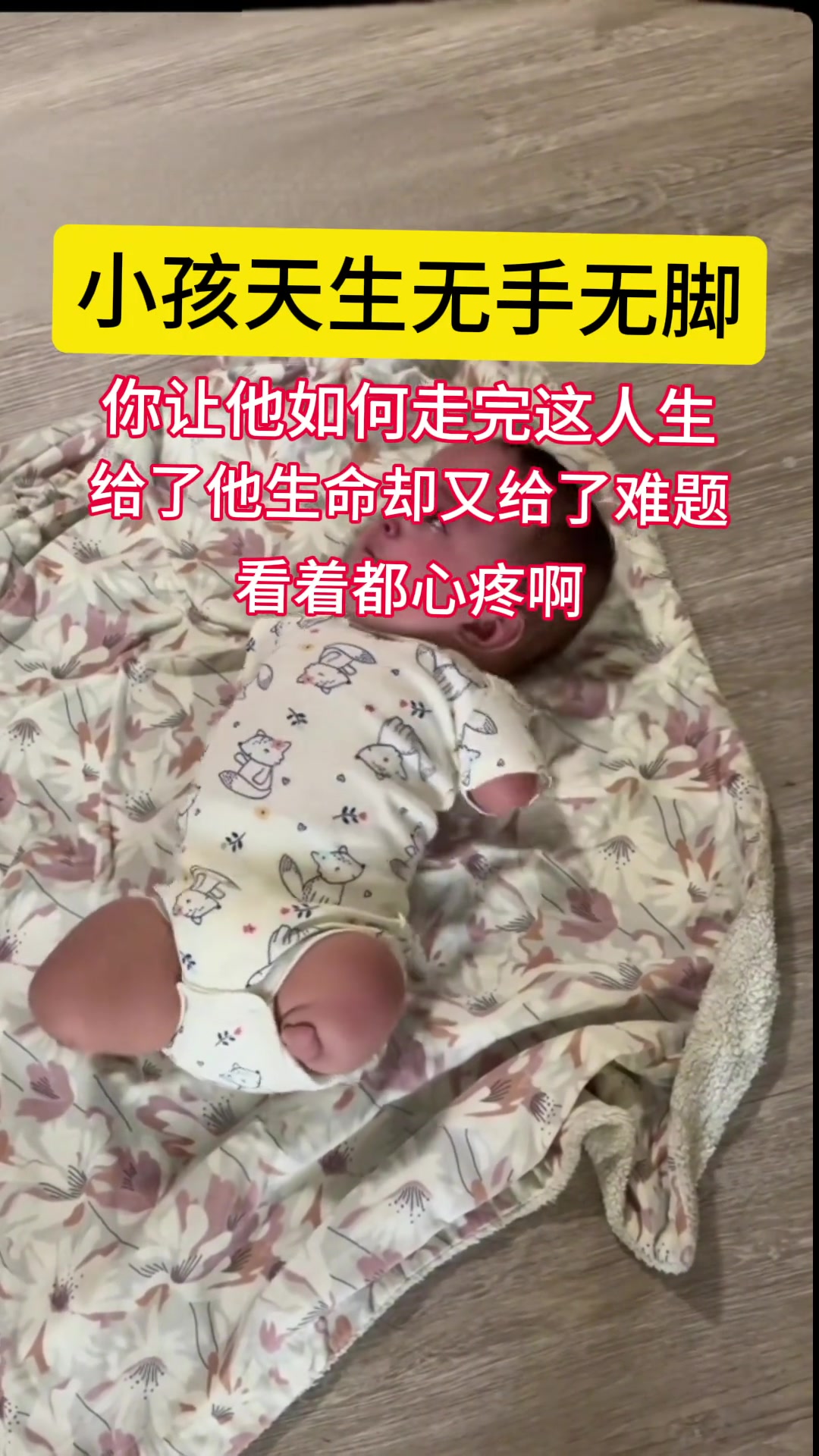 小孩天生无手无脚，看着都心疼啊！