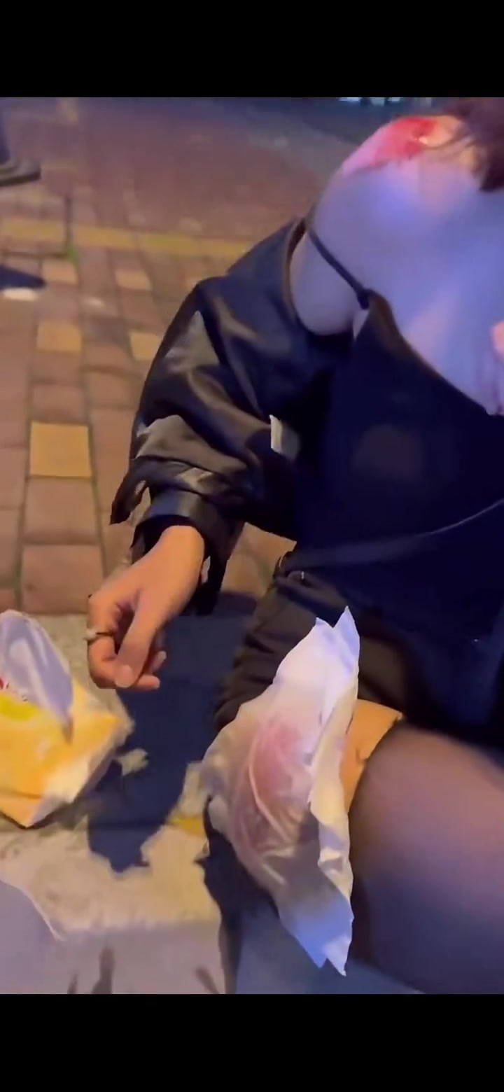 现在舒服了这是往她的大腿伤口上撒盐么