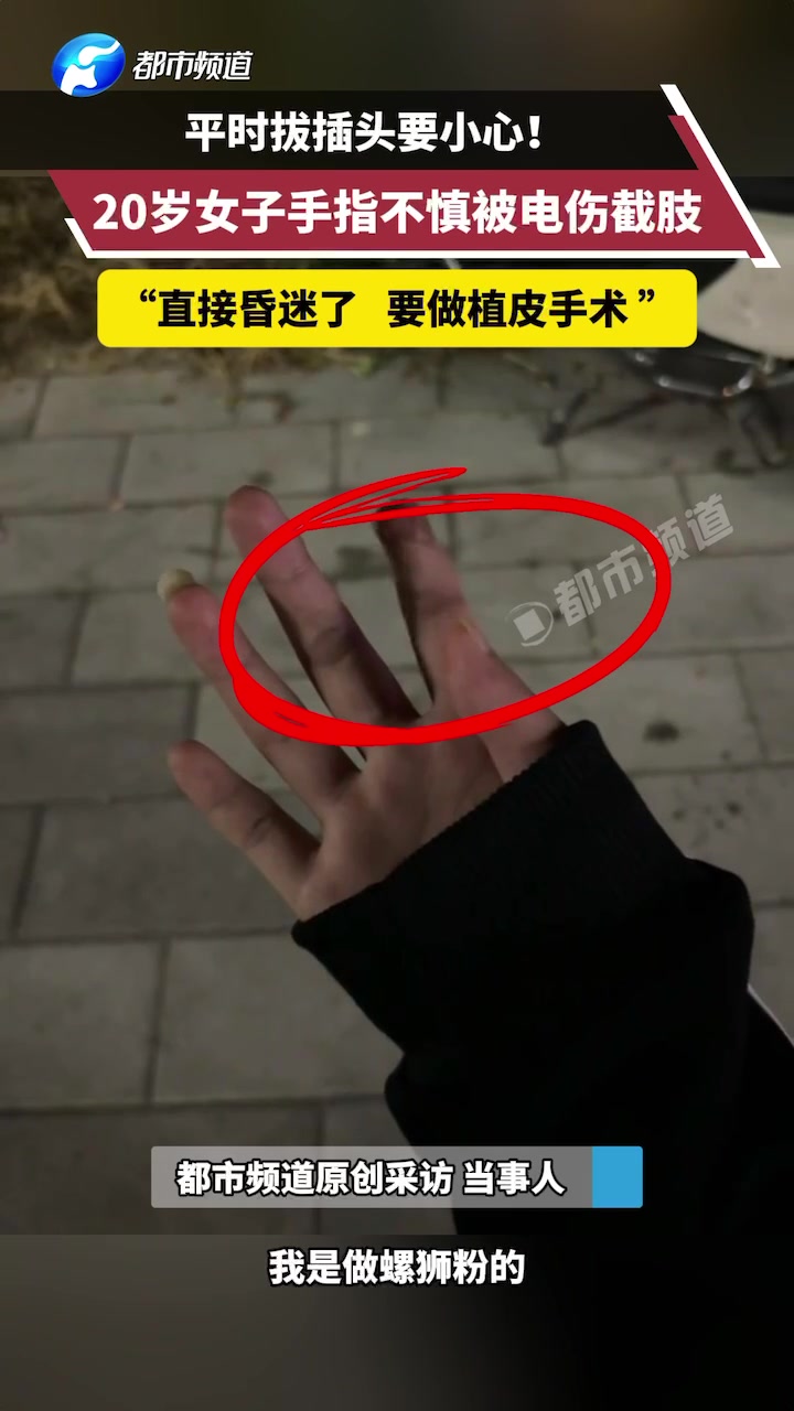女子拔插头被电伤截肢！大家选择插座和电器尽量选择大品牌的！