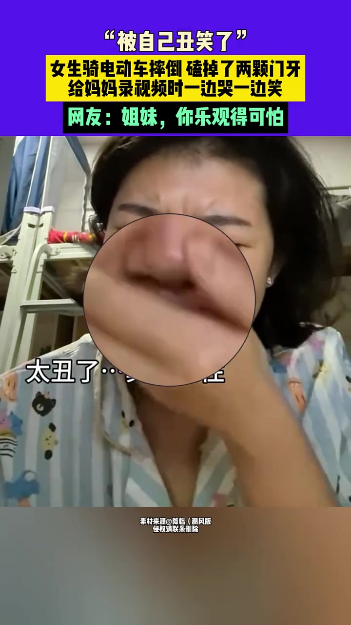 女子骑电动车磕掉牙齿，结果被自己丑笑了