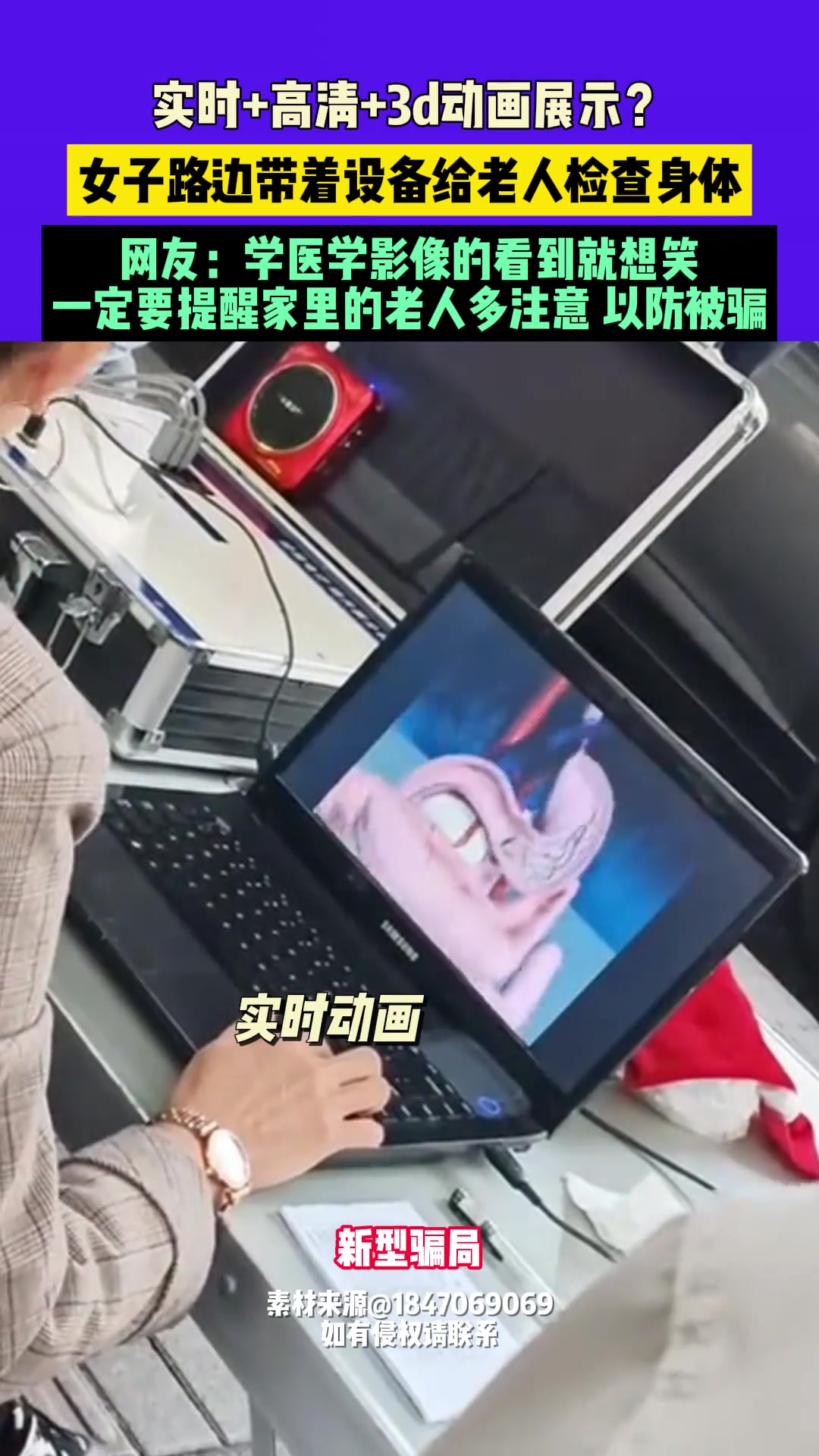 实时+高清+3d动画展示女子路边带着设备给老人检查身体