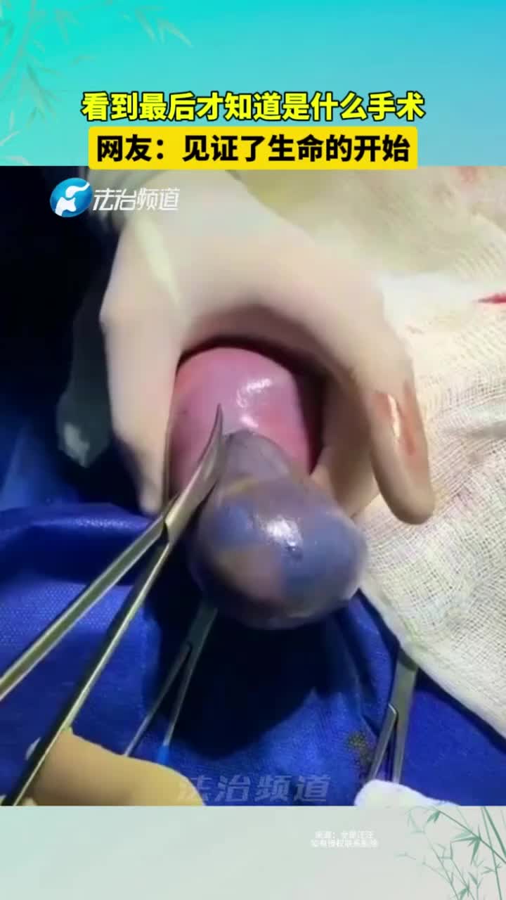 看到最后才知道是什么手术！一个新生命