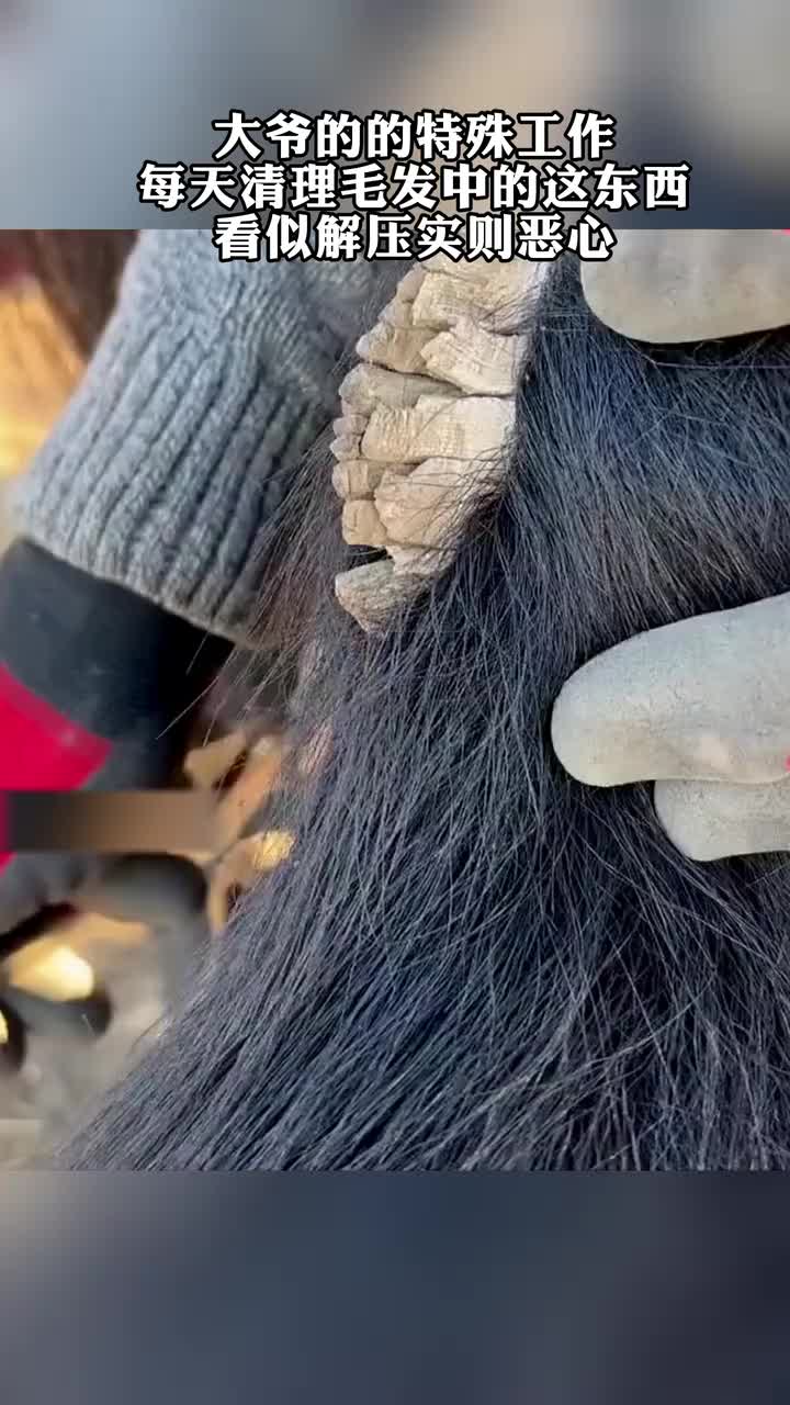 大爷的的特殊工作，每天清理毛发中的这东西！