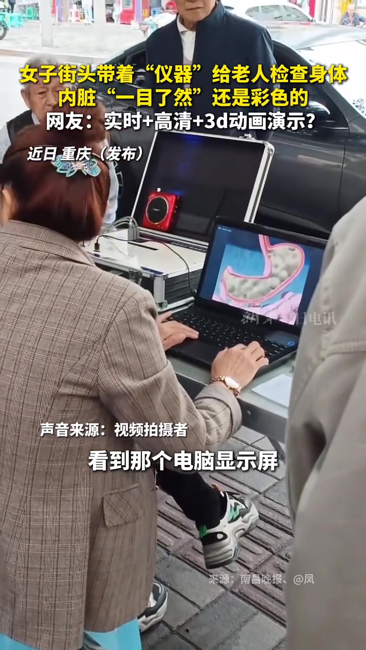 女子街头带“仪器”给老人检查身体，你这领先多少年了