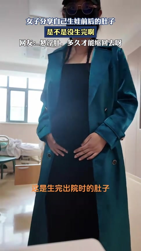 是不是还有一个没生啊！女子分享自己生娃前后的肚子！