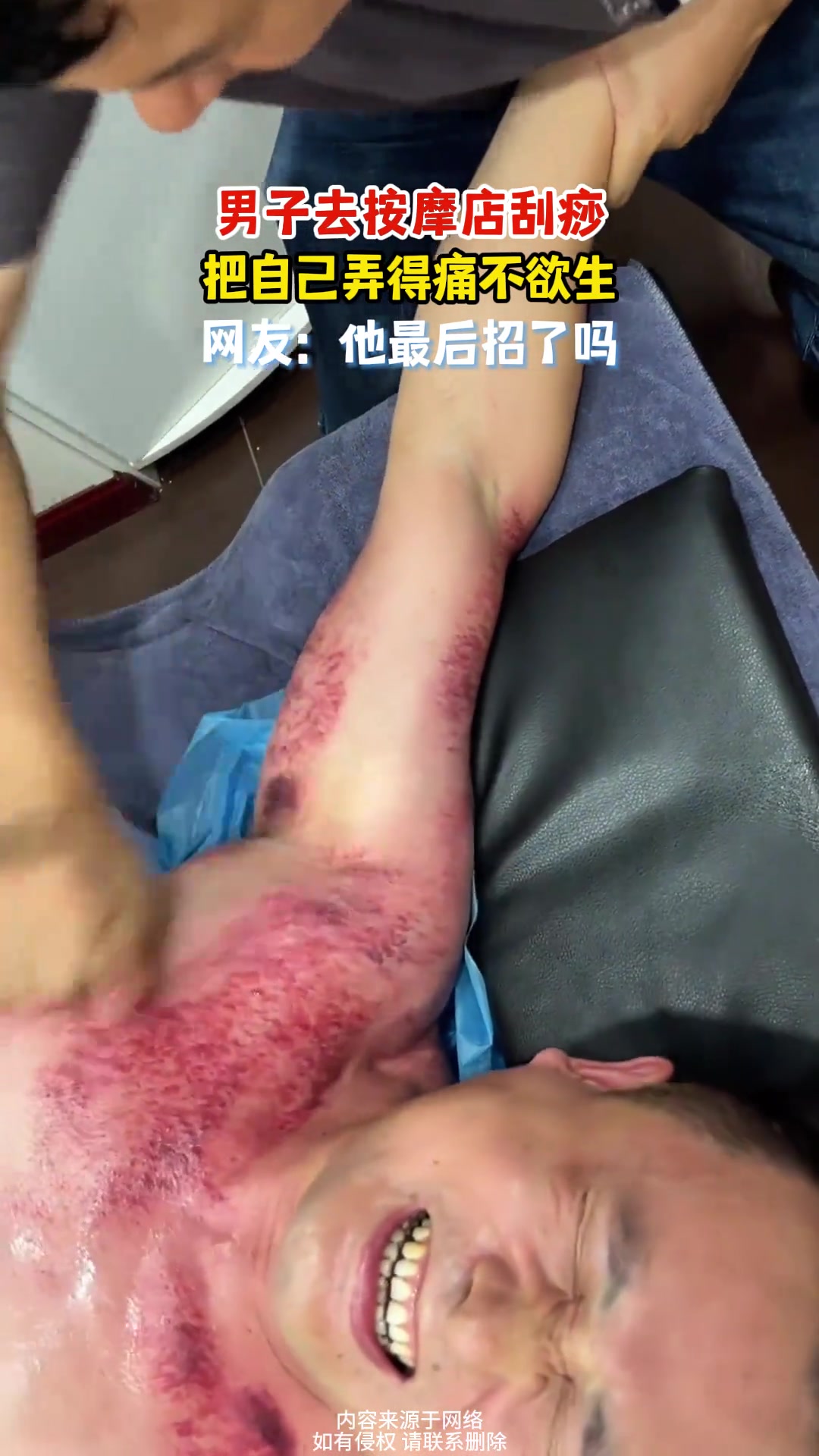 男子去按摩店刮痧，把自己弄得痛不欲生，网友：他最后招了吗