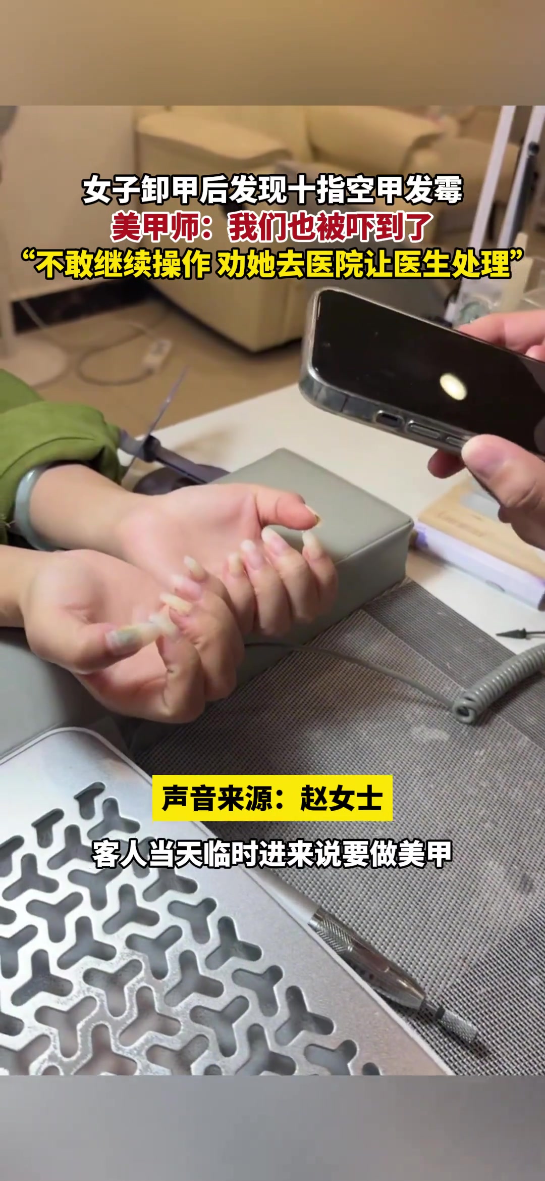 女子卸甲后发现十指空甲发霉，美甲师：我们也被吓到了