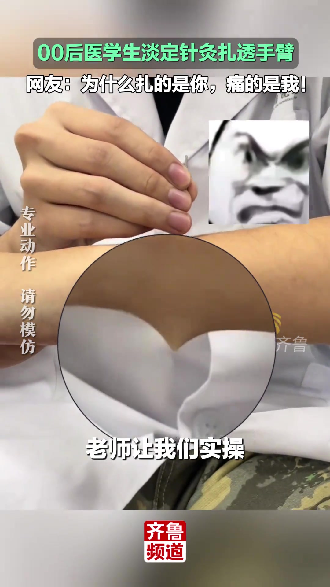 太勇了！00后医学生淡定针灸扎透手臂