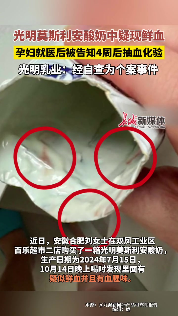 光明莫斯利安酸奶中疑现鲜血孕妇就医后被告知4周后抽血化验