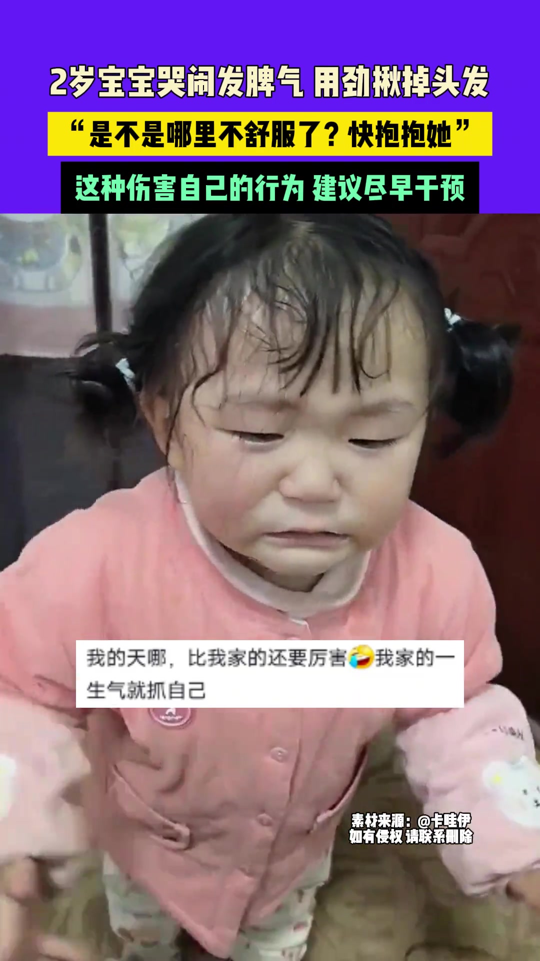 2岁宝宝哭闹发脾气用劲揪掉头发