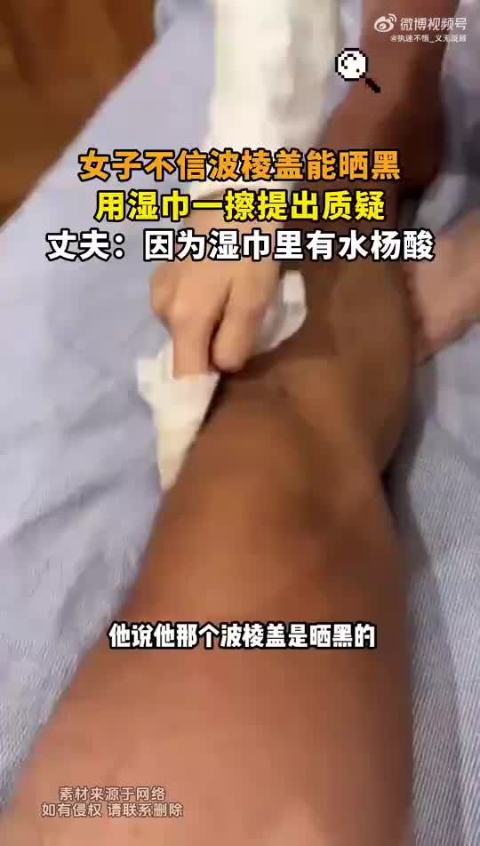 女子不信波棱盖能晒黑，用湿巾一擦提出质疑！