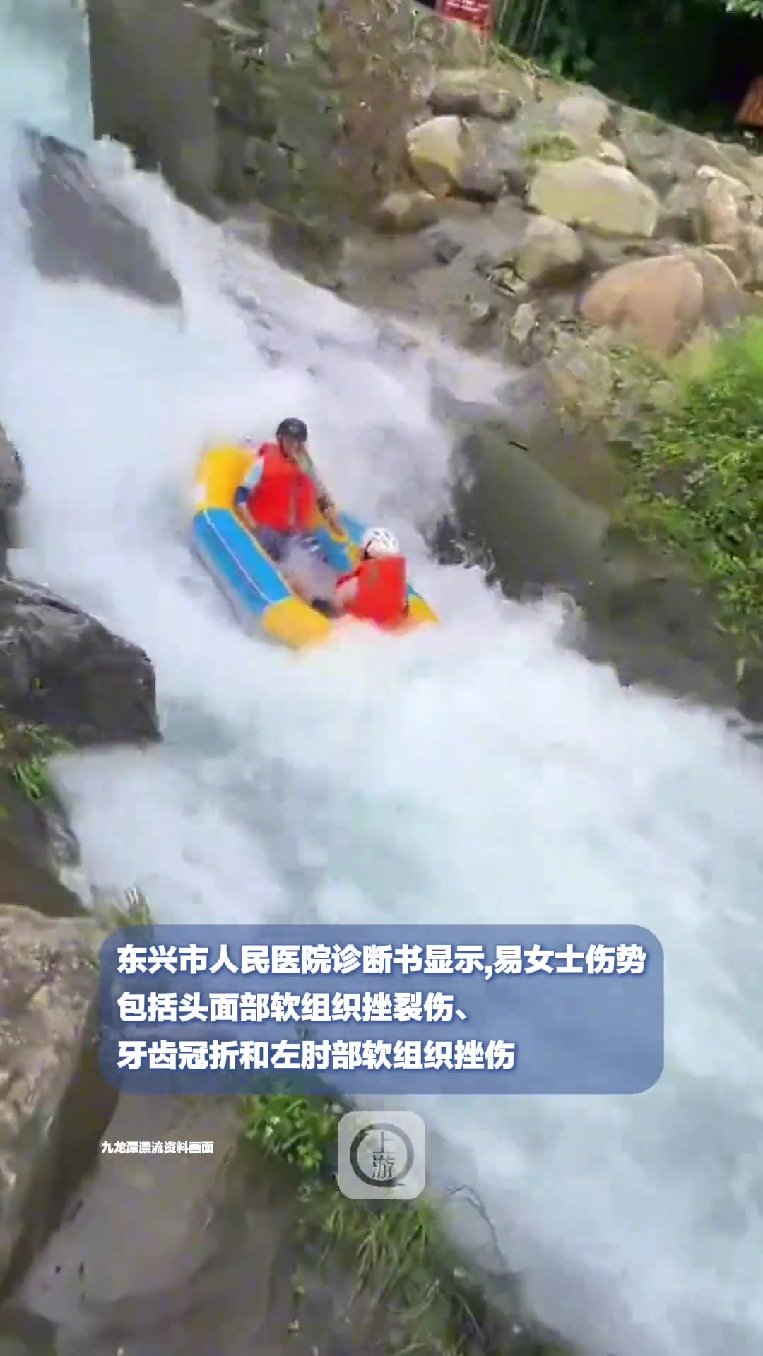 恐怖！女子玩漂流摔断两颗门牙面临毁容景区：她没按讲解操作