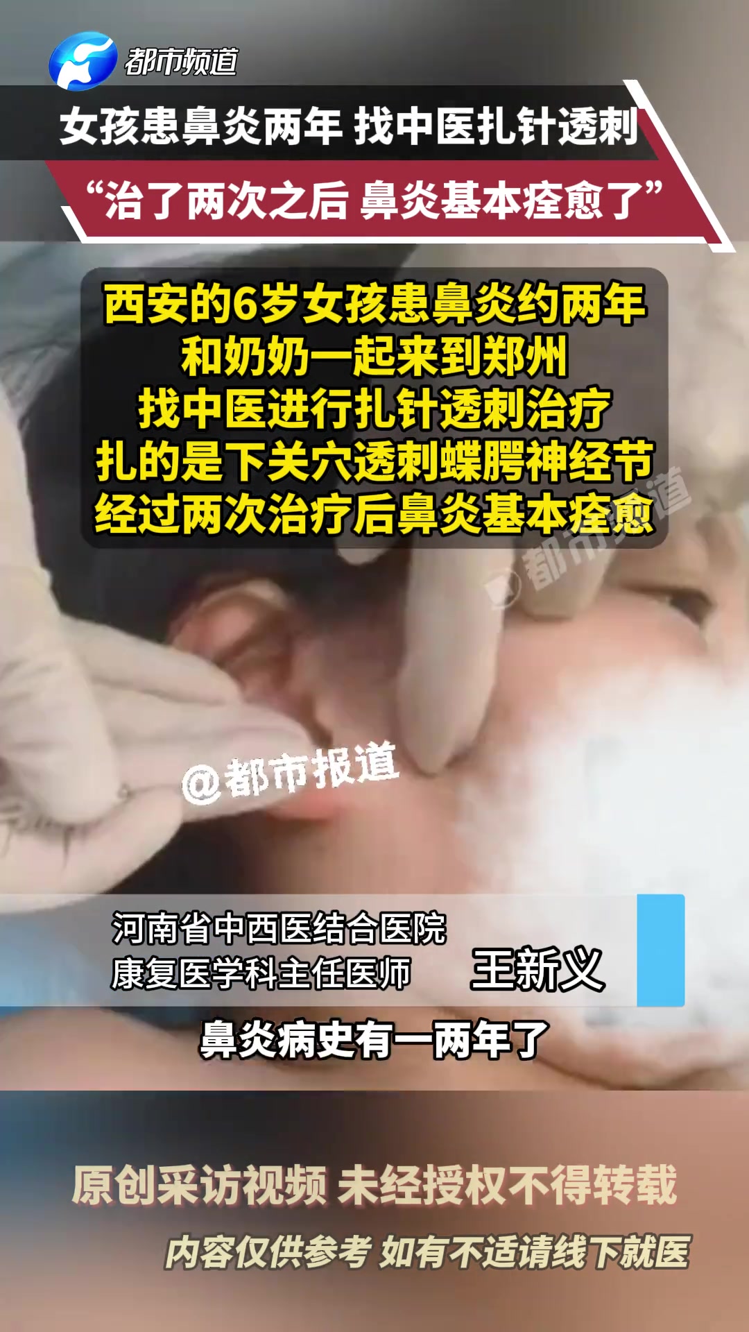 女孩患鼻炎找中医扎针，看这操作不用扎我都好了！