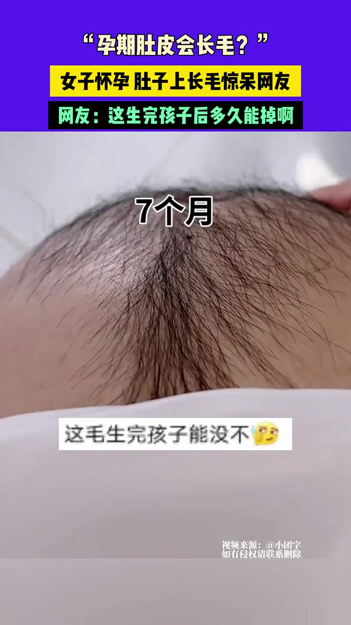 “孕期肚皮会长毛”，女子怀孕肚子上长毛惊呆网友