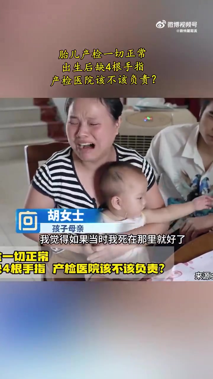 胎儿产检一切正常，出生后缺4根手指！！