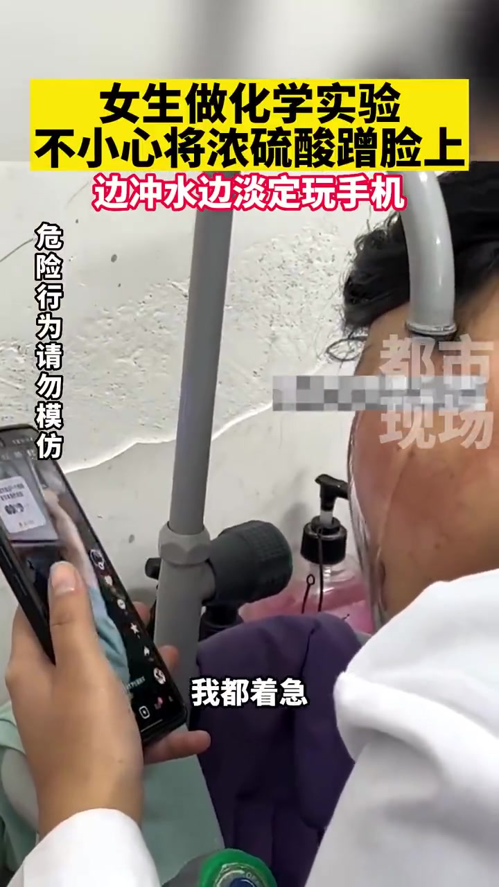 女生做化学实验，不小心将浓硫酸蹭到脸上，边冲水边淡定玩手机！