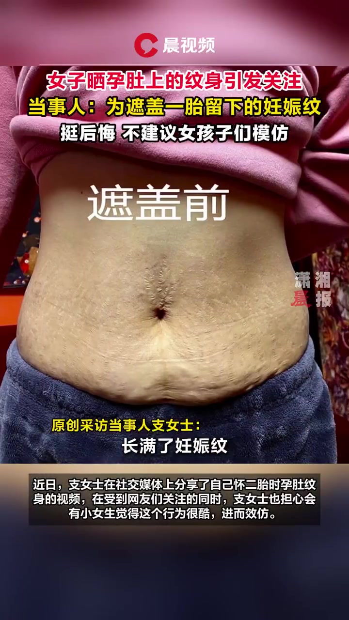 女子为遮一胎妊娠纹在腹部纹身！