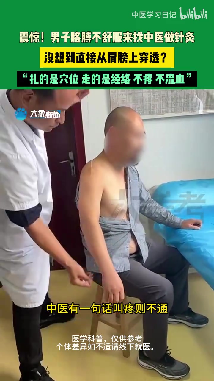 这就是中医的神奇嘛，哥们你这样真的不觉得痛嘛！！