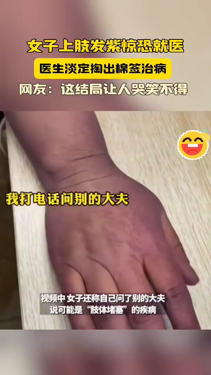 女子上肢发紫惊恐就医，医生淡定掏出棉签治病
