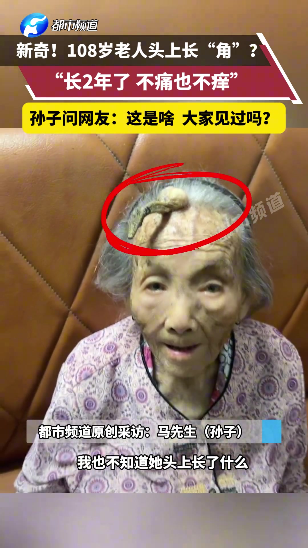 新奇108岁老人头上长“角”?孙子问网友这是啥大家见过吗?