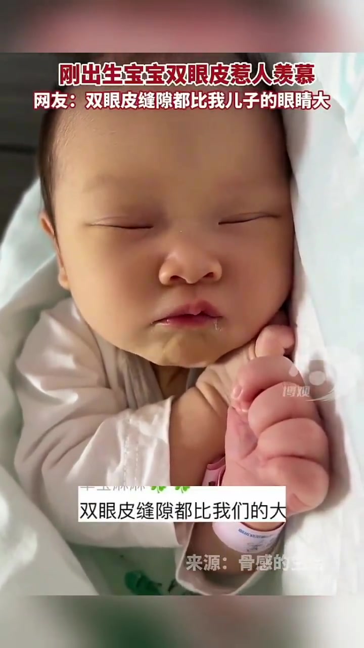 刚出生宝宝双眼皮惹人羡慕网友：双眼皮缝隙都比我儿子眼睛大！！