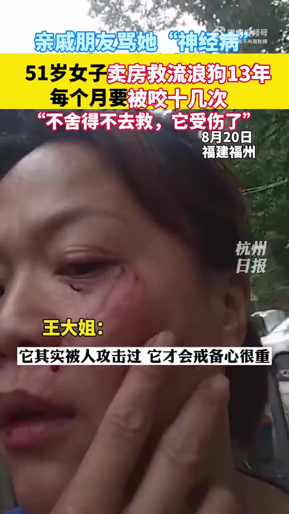 大姐卖房救助流浪狗每月被咬十几次：它们只是被攻击过