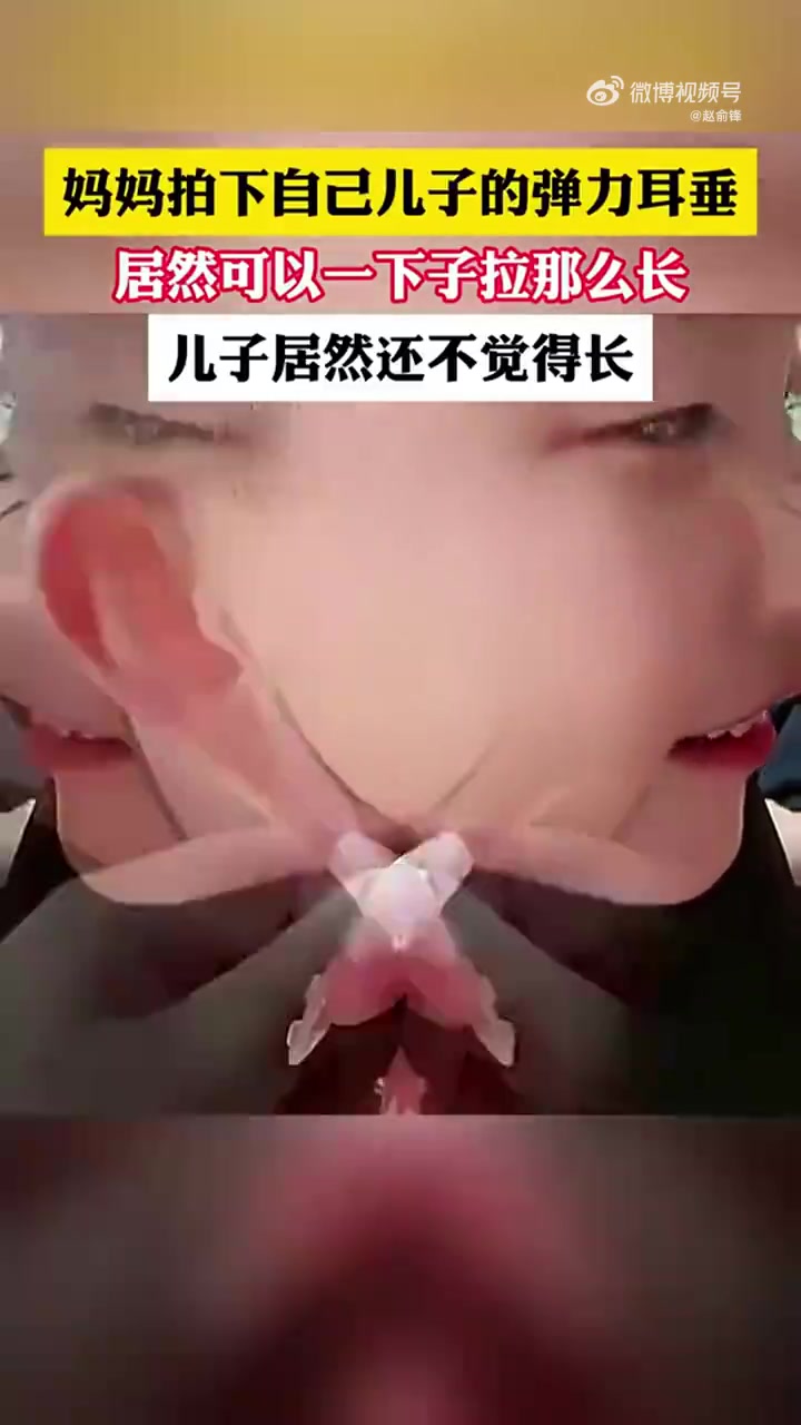 妈妈拍下自己儿子的弹力耳垂，居然可以一下子拉那么长！