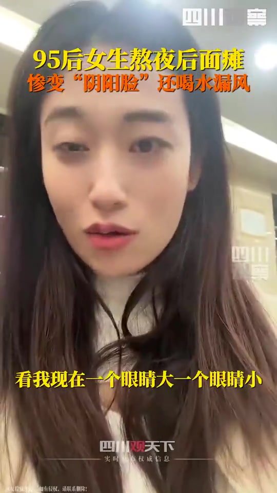 原来真的有面瘫这种症状，95后女生熬夜后面瘫