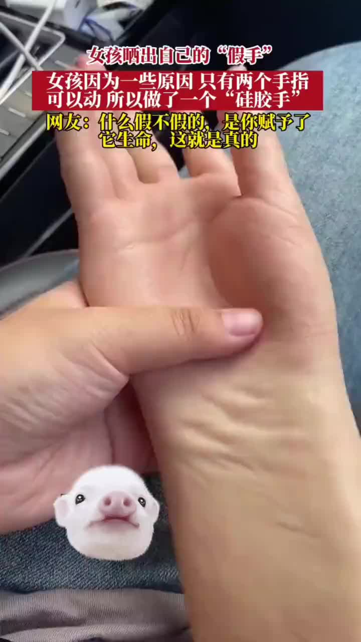 女孩晒出自己的“假手”，感觉很逼真啊！