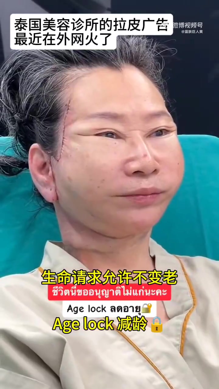 太恐怖！泰国一家美容诊所特意发在网上展示的顾客拉皮效果！
