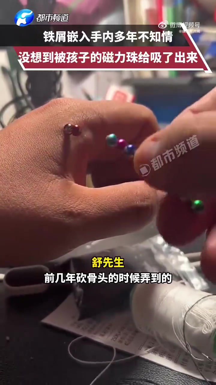 这还蛮可怕的，但算是好事吧好歹皮肤下没有异物了
