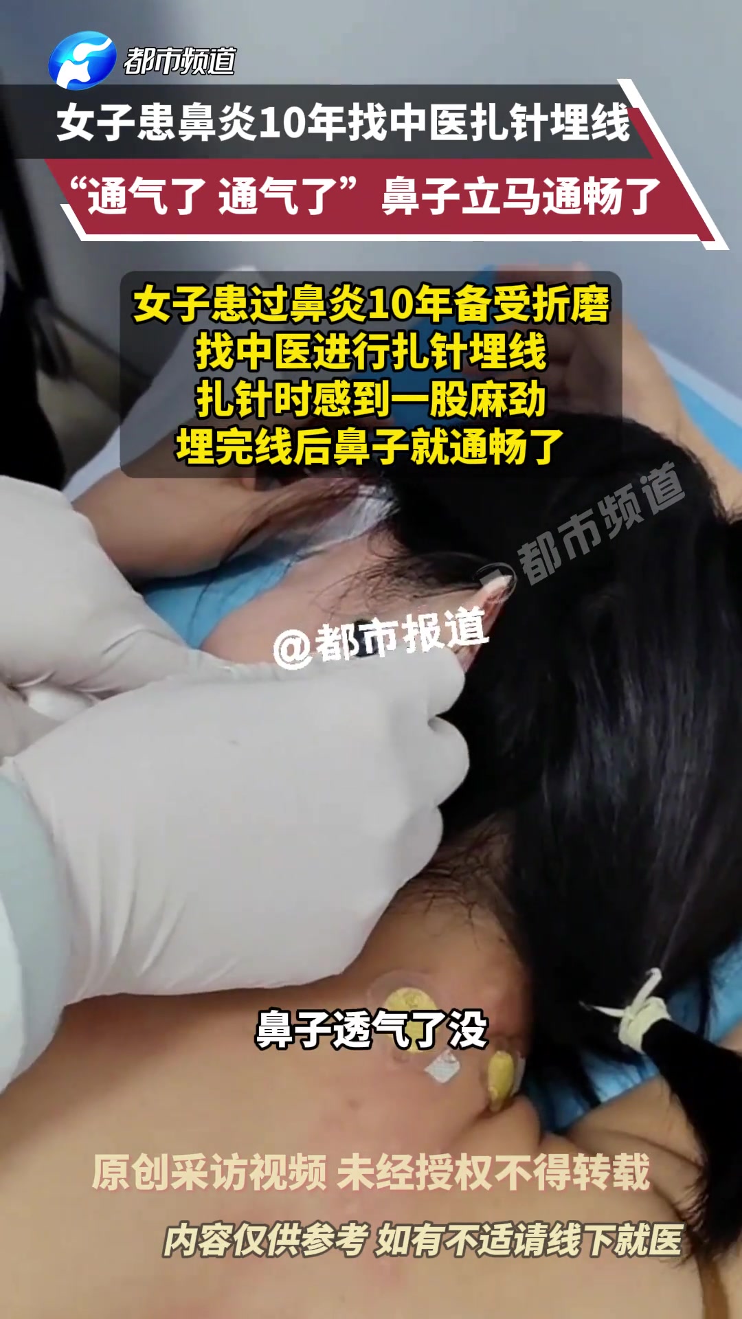女子患鼻炎10年，找中医扎针埋线，“通气了，通气了”