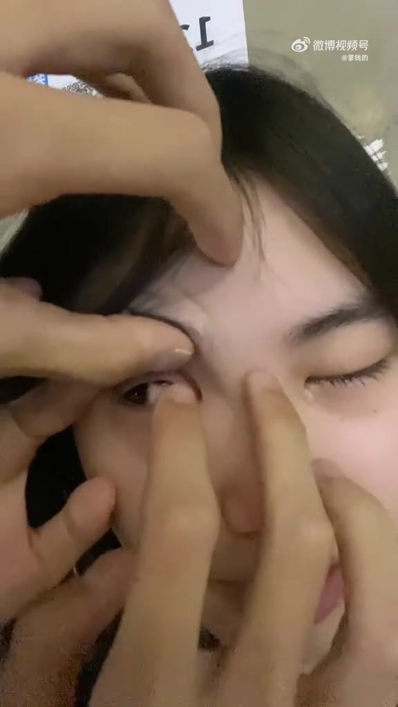 女孩子就因为掉了几滴眼泪，结果美瞳卡住了，太吓人了
