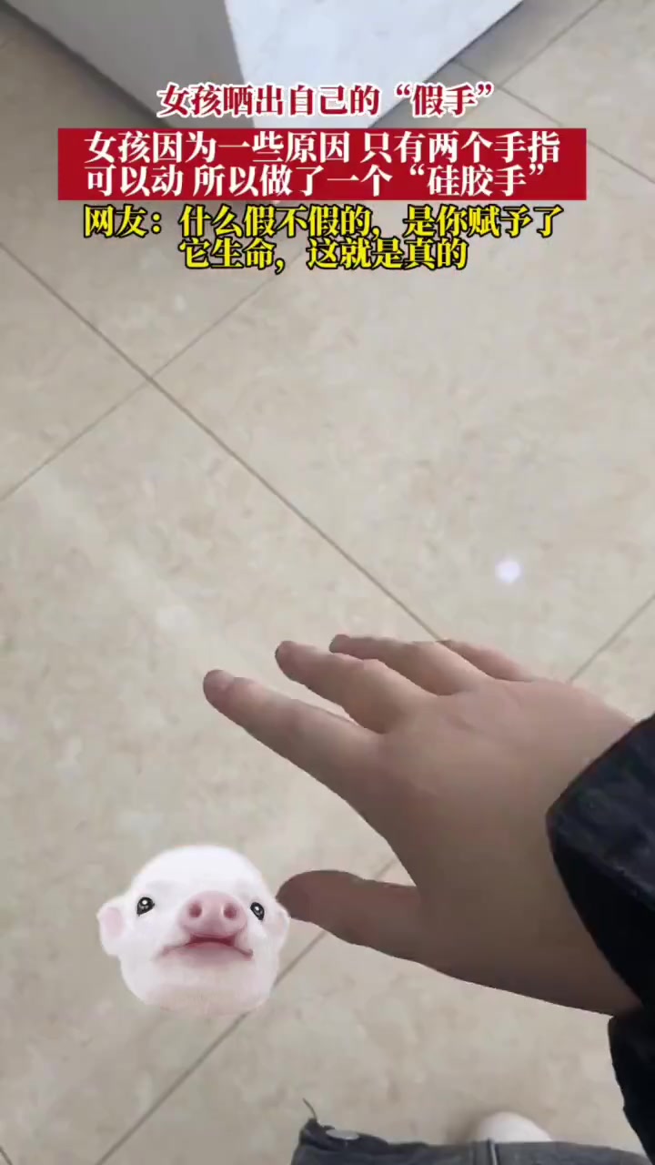 和真的一样！女孩晒出自己的“假手”！