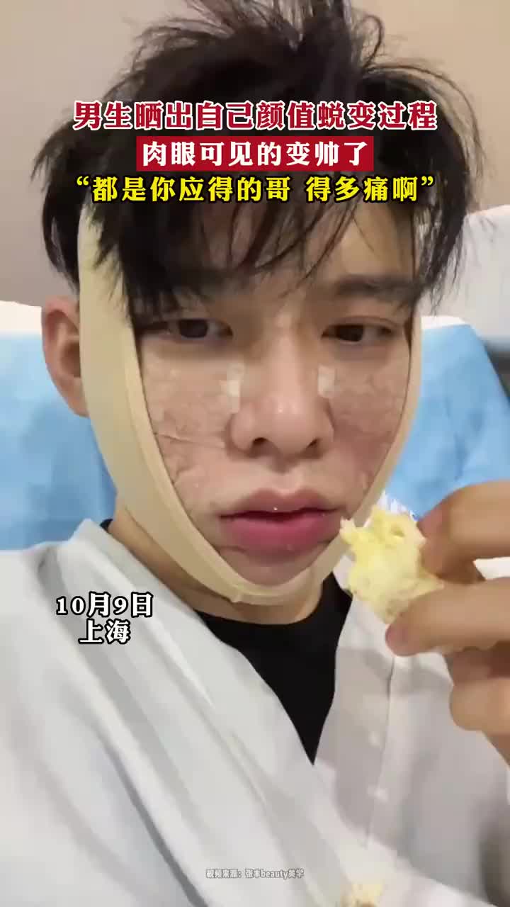 大家有想过整容吗男生晒出自己颜值蜕变过程！