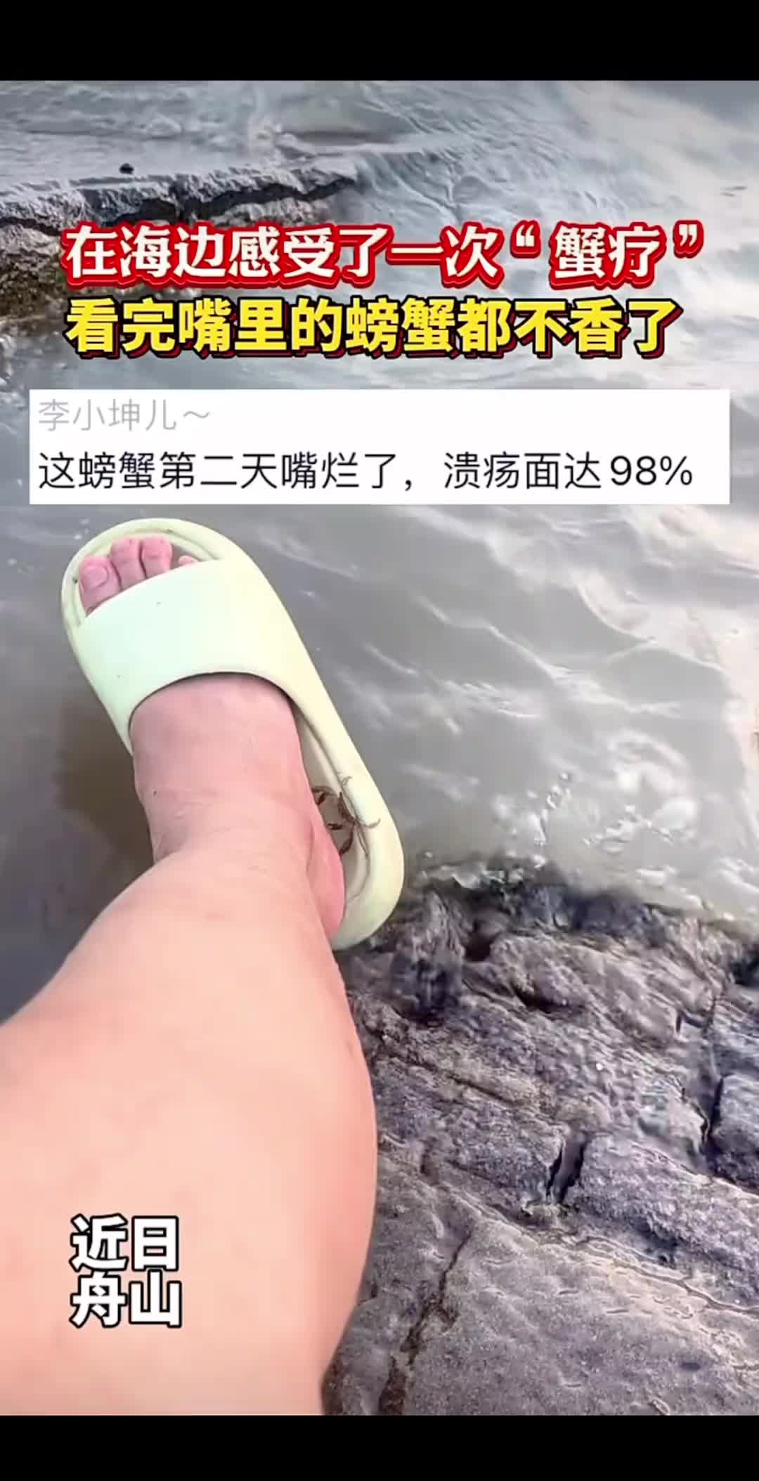 在海边感受了一次“蟹疗”！网友：看完嘴里的螃蟹都吐了