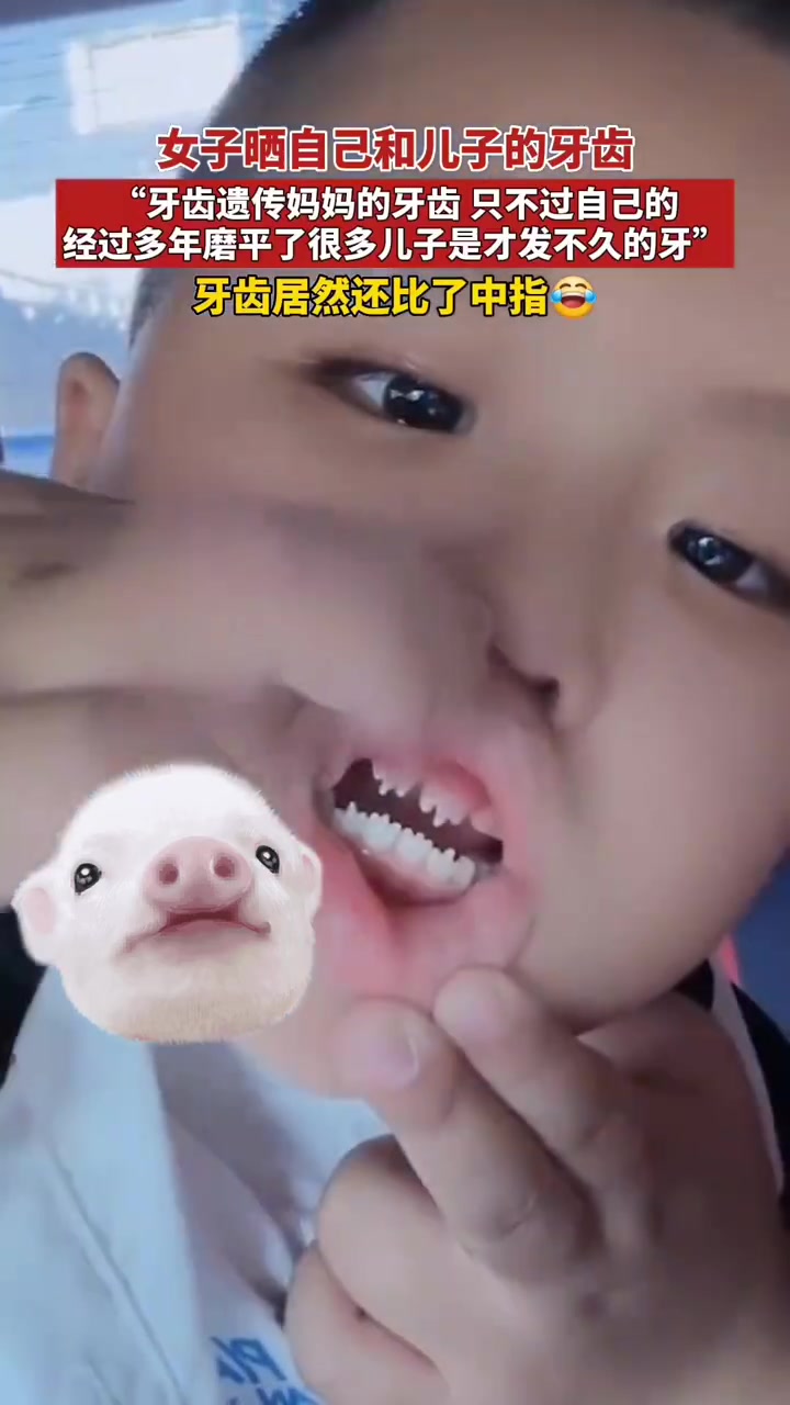 你这个牙齿怎么还会比中指！