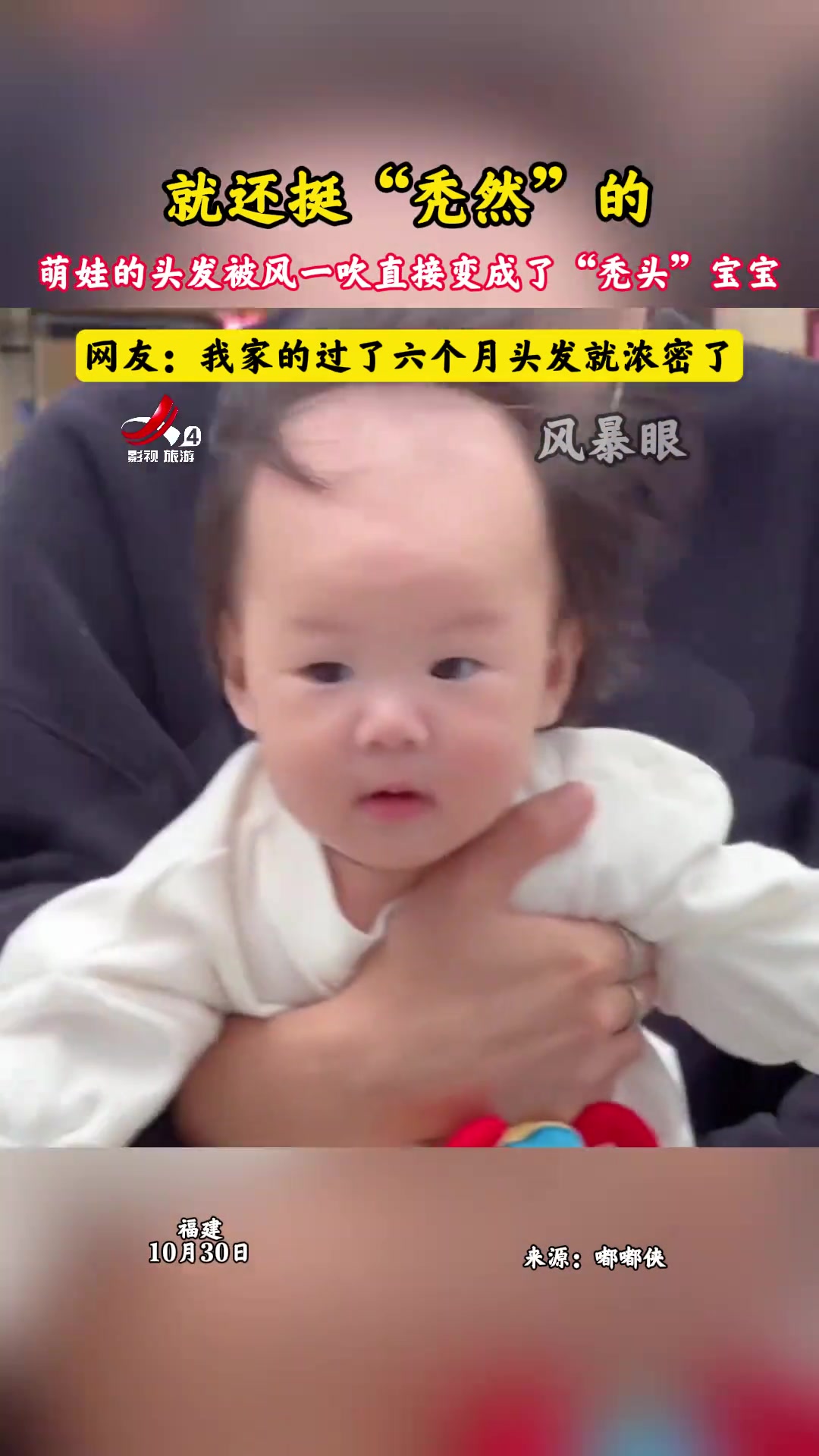 萌娃头发被风一吹就“秃”了半个头头发又稀疏又茂密的