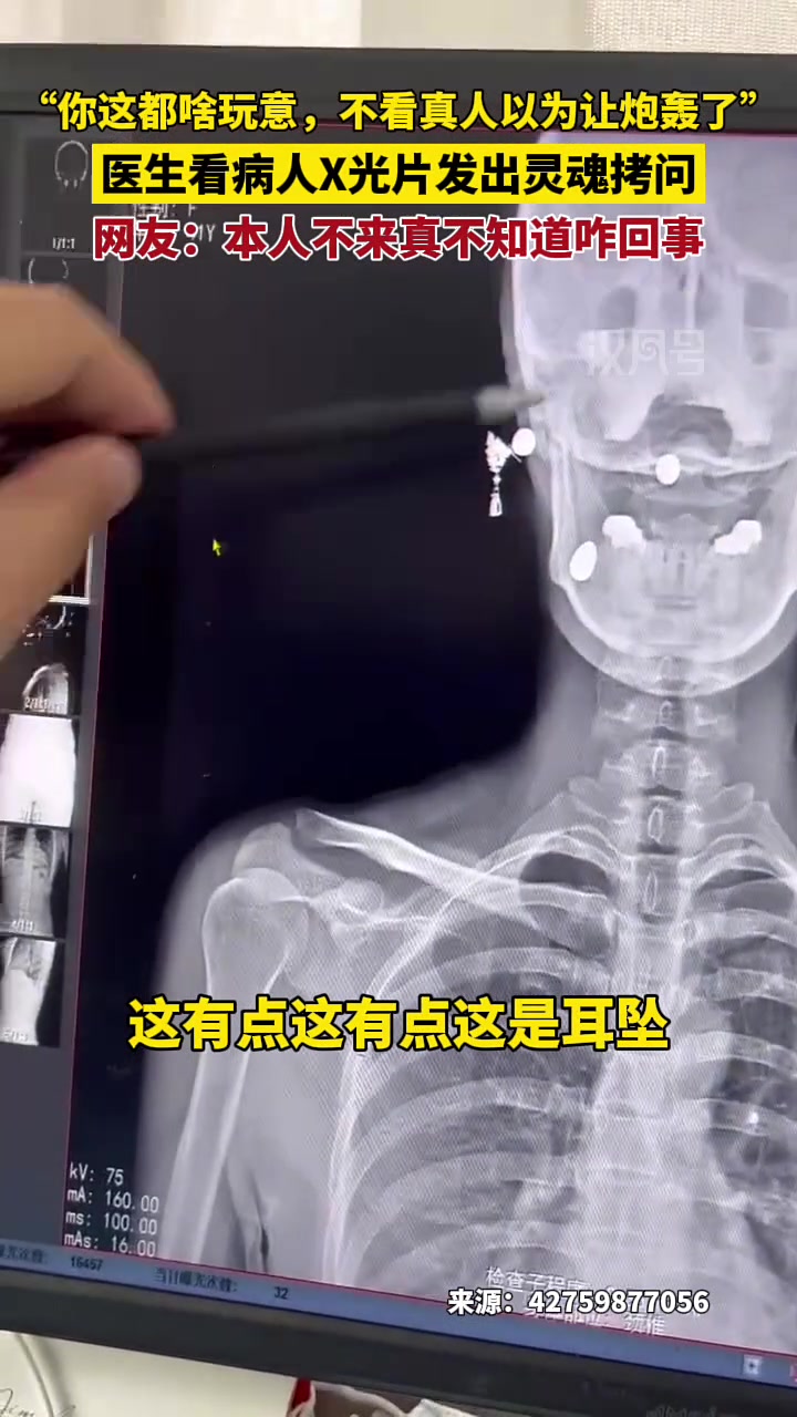 医生看病人X光片后发出灵魂拷问