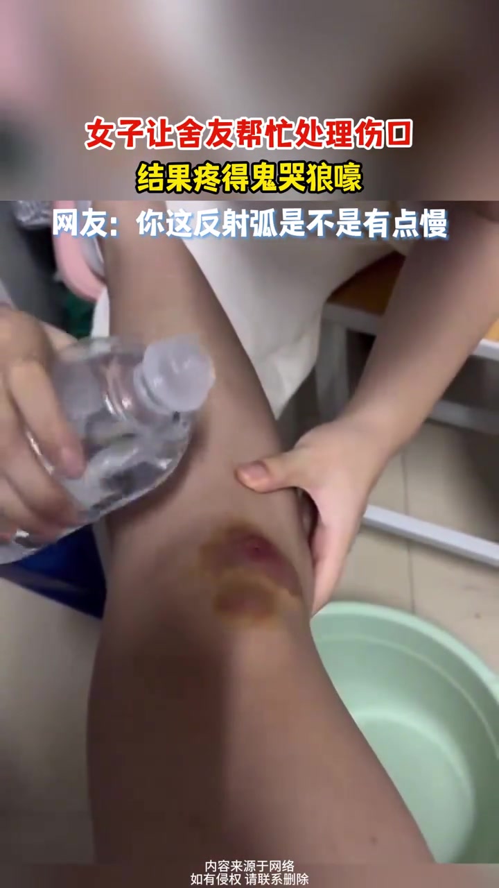 痛！女子让舍友帮忙处理伤口结果疼得鬼哭狼嚎