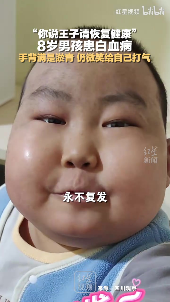 “你说王子请恢复健康”8岁男孩患白血病，仍微笑给自己打气