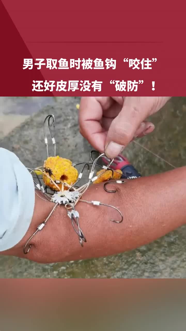 男子取鱼时被鱼钩“咬住”，还好皮厚没有“破防”！