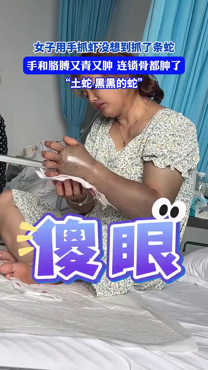 女子用手抓虾没想到抓了条蛇，手和胳膊又青又肿连锁骨都肿了