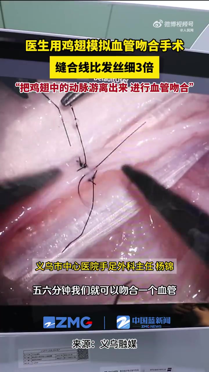 缝合线比发丝细3倍，刀尖上的技术需要“一万小时”练习