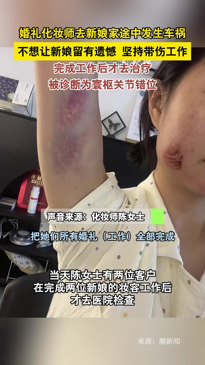 化妆师去新娘家途中发生车祸不想让新娘们留有遗憾坚持带伤工作