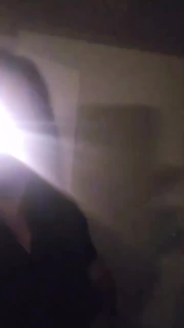 网友患癌后摘除了一只眼睛，于是他就装了个超酷的“闪光灯”假眼