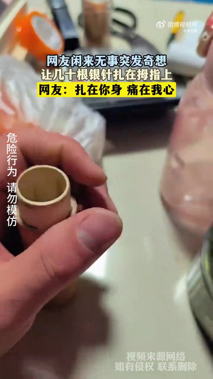 网友闲来无事突发奇想，让几十根银针扎在拇指上