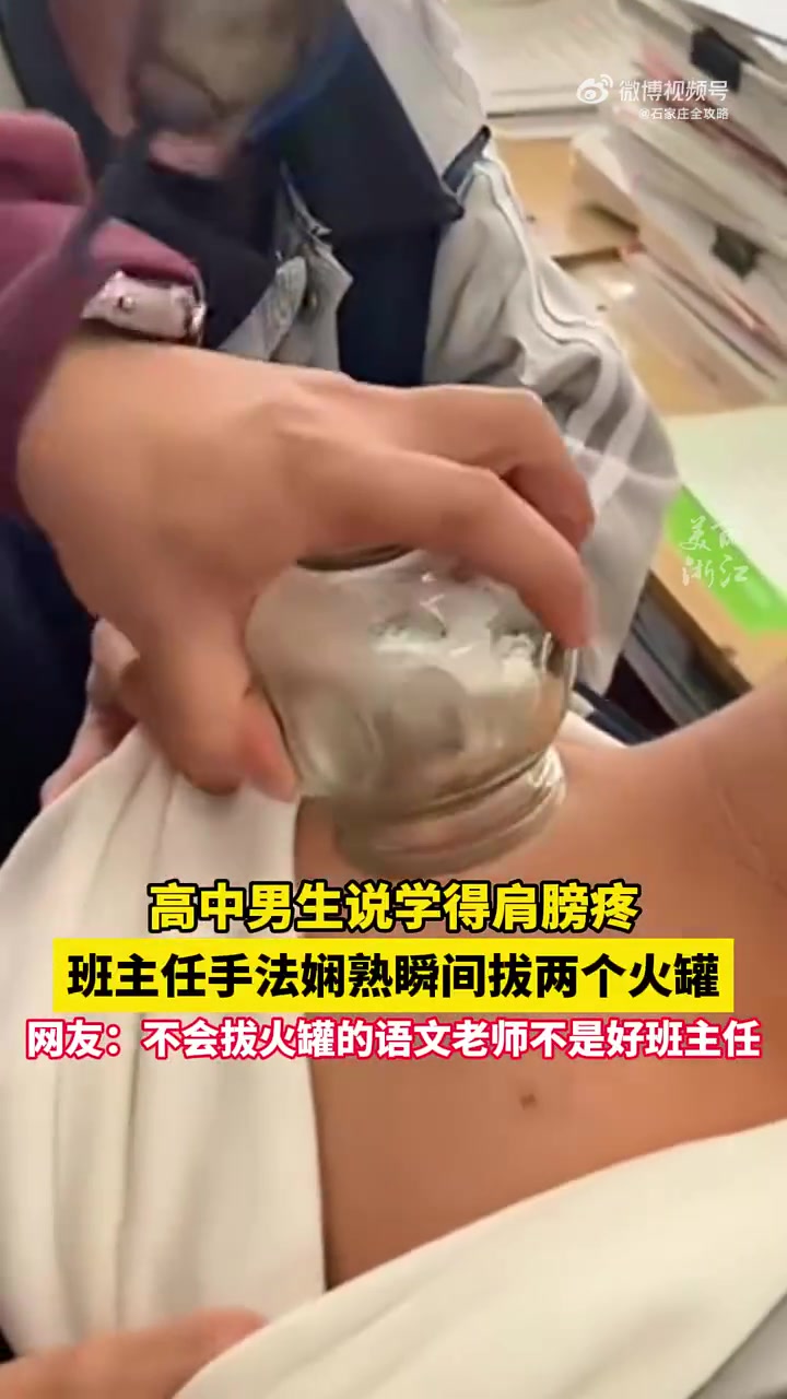 高中男生说学得肩膀疼，班主任手法娴熟瞬间拔两个火罐