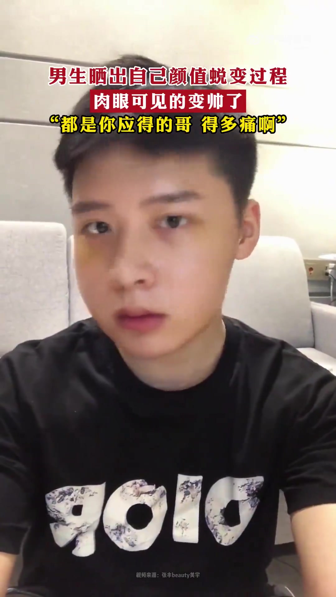 男生晒颜值蜕变，肉眼可见变帅，“都是你应得的，哥得多痛啊”